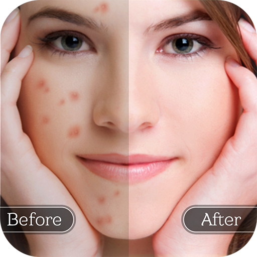 Face Blemish Remover – Smooth Skin & Beautify Face APK v1.5 Download
